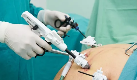 Bariatric Surgery