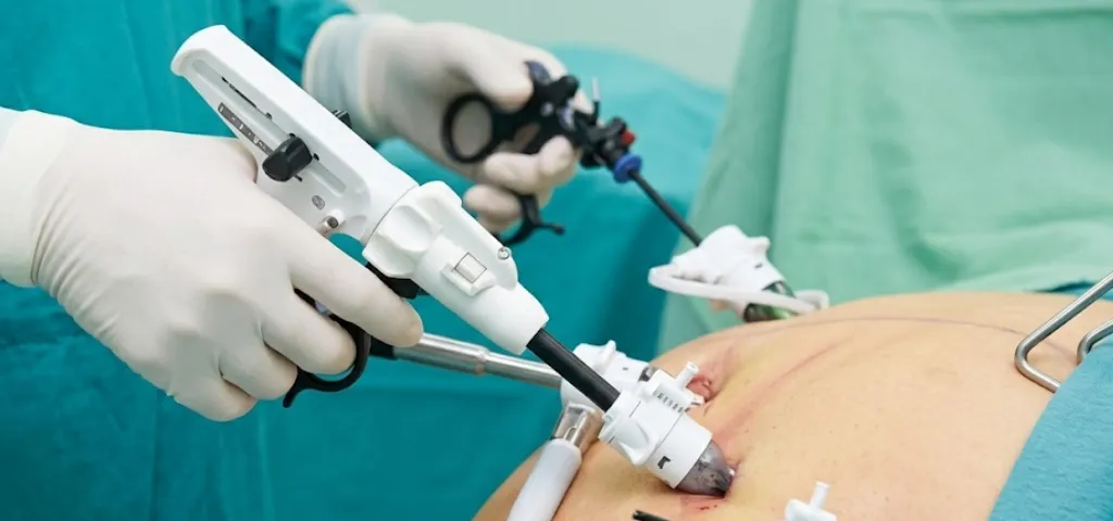 Bariatric Surgery
