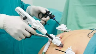 Bariatric Surgery